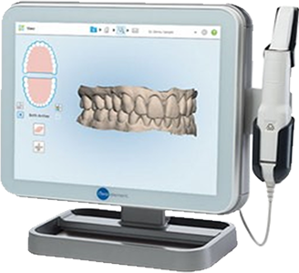 iTero - Digital dentistry - Ivo Dentech
